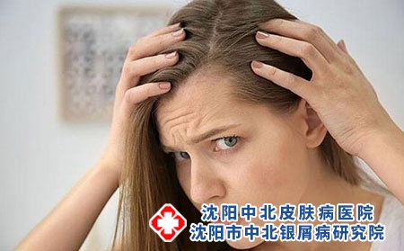 2 (233)頭發 2 (233)頭發